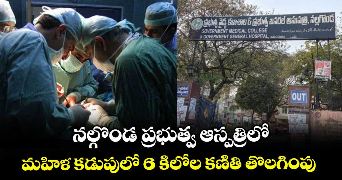 నల్గొండ ప్రభుత్వ ఆస్పత్రిలో .. మహిళ కడుపులో 6 కిలోల కణితి తొలగింపు