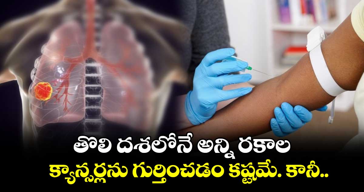 Cancer Disease: తొలి దశలోనే అన్ని రకాల క్యాన్సర్లను గుర్తించడం కష్టమే. కానీ..