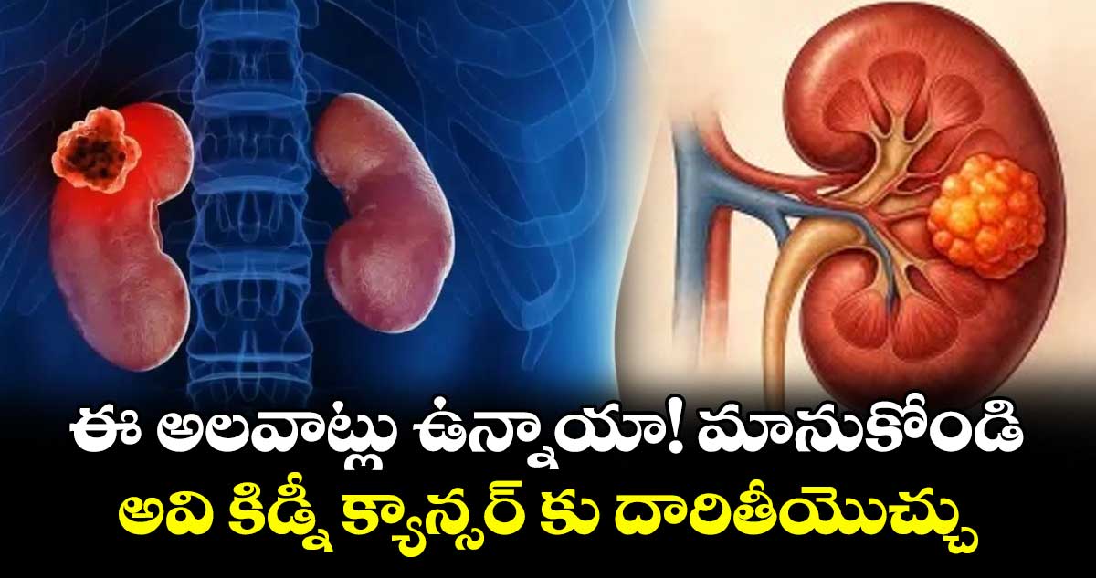 Health alert: ఈ అలవాట్లు ఉన్నాయా!మానుకోండి..అవి కిడ్నీ క్యాన్సర్ కు దారితీయొచ్చు