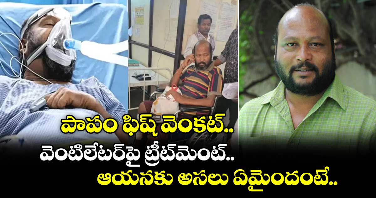 Fish Venkat: పాపం ఫిష్ వెంకట్.. వెంటిలేటర్⁬పై ట్రీట్⁬మెంట్.. ఆయనకు అసలు ఏమైందంటే..