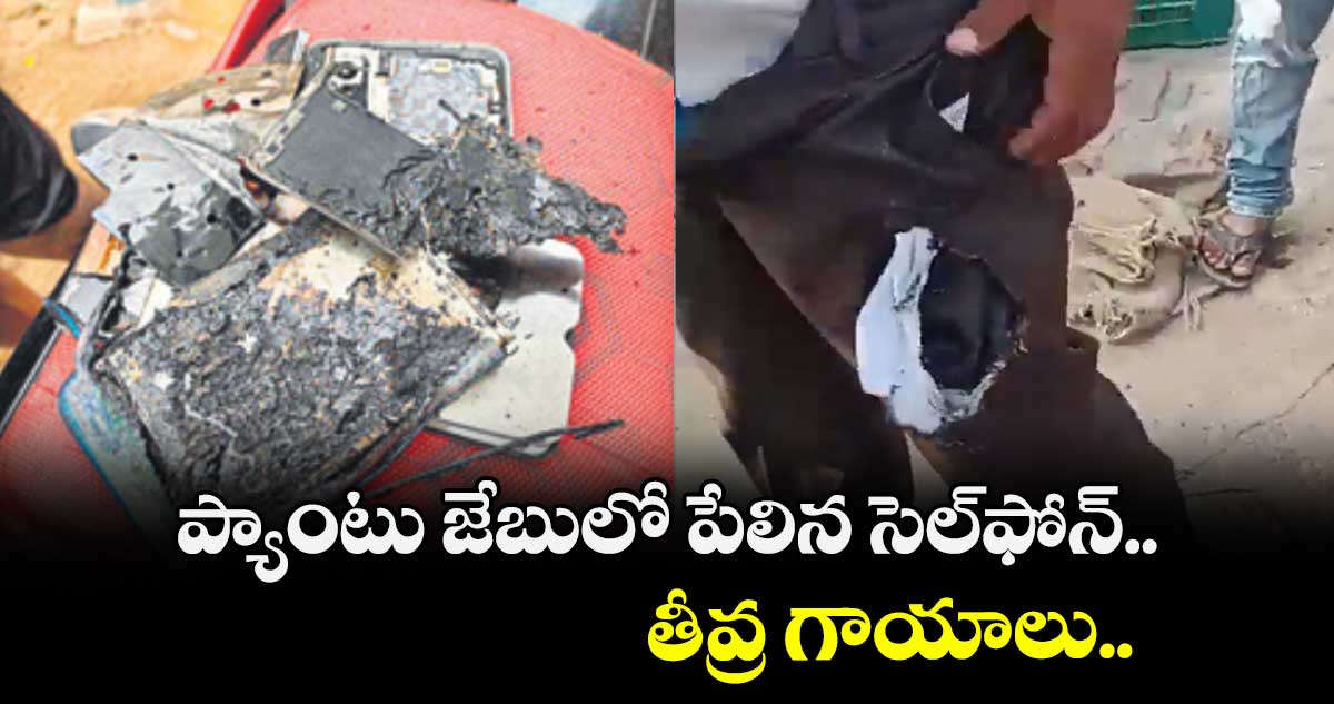 ప్యాంటు జేబులో పేలిన సెల్ఫోన్.. తీవ్ర గాయాలు..