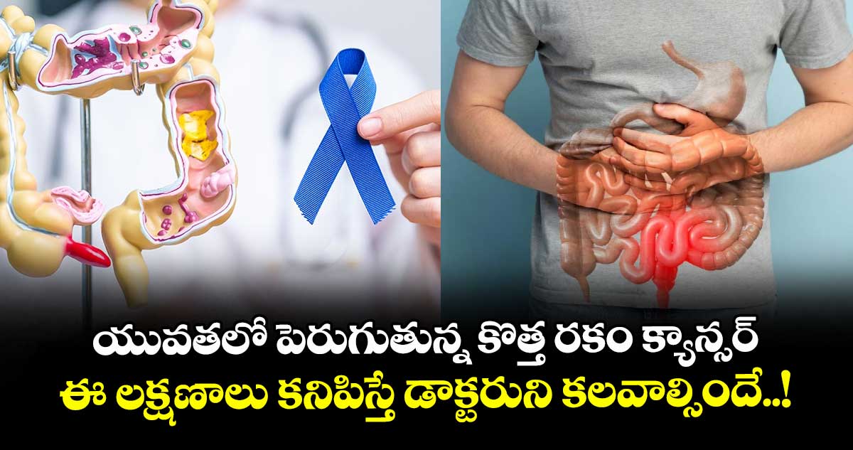 యువతలో పెరుగుతున్న కొత్త రకం క్యాన్సర్: ఈ లక్షణాలు కనిపిస్తే డాక్టరుని కలవాల్సిందే..!