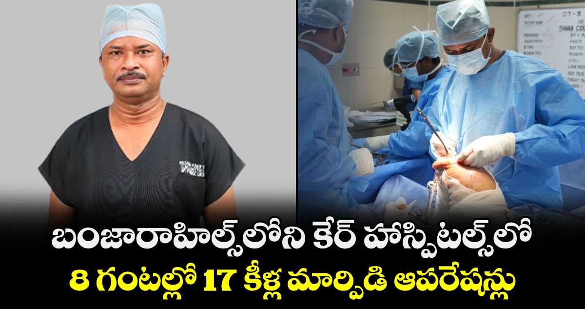 బంజారాహిల్స్‌‌లోని కేర్ హాస్పిటల్స్‌‌లో .. 8 గంటల్లో 17 కీళ్ల మార్పిడి ఆపరేషన్లు 