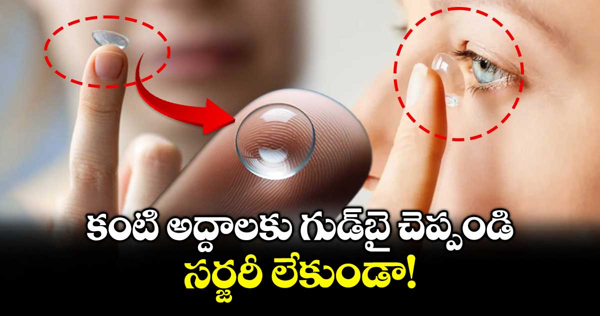 Ortho K lenses:కంటి అద్దాలకు గుడ్‌బై చెప్పండి..సర్జరీ లేకుండా!