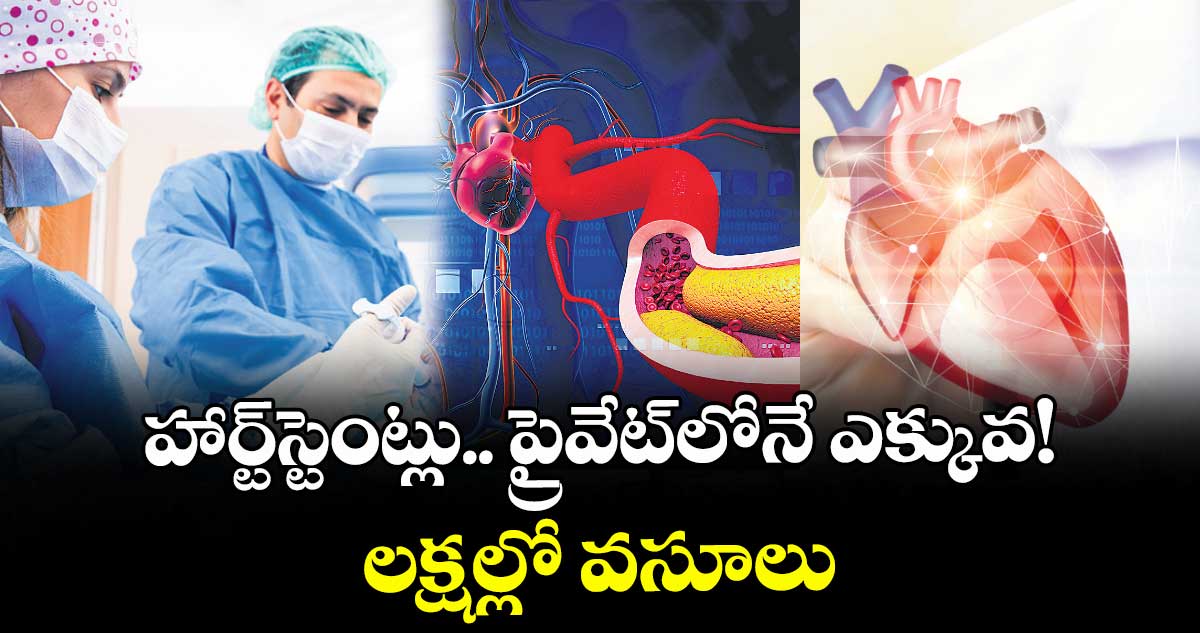 హార్ట్స్టెంట్లు.. ప్రైవేట్లోనే ఎక్కువ!..లక్షల్లో వసూలు