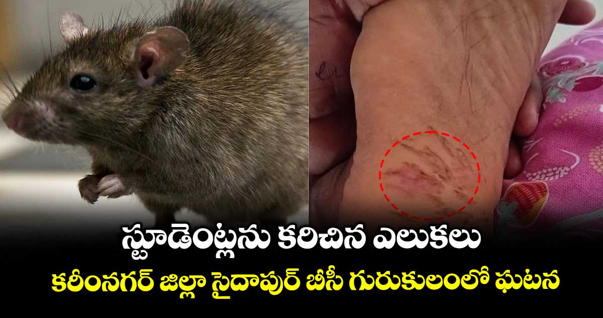 స్టూడెంట్లను కరిచిన ఎలుకలు..కరీంనగర్‌‌ జిల్లా సైదాపుర్‌‌ బీసీ గురుకులంలో ఘటన