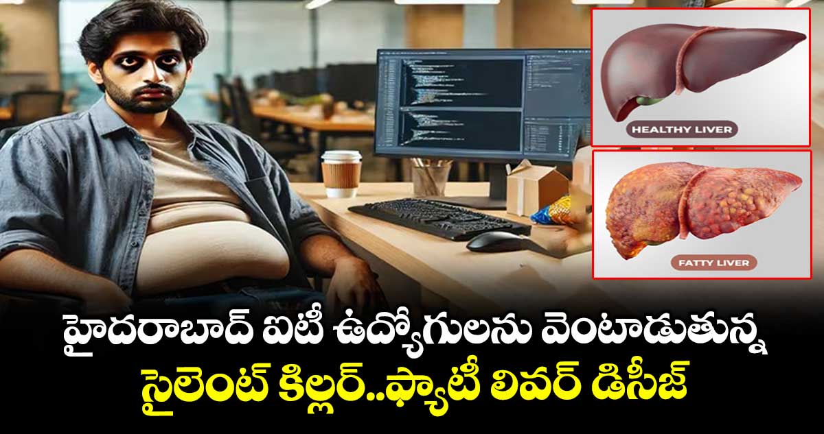 హైదరాబాద్ ఐటీ ఉద్యోగులను వెంటాడుతున్న ..సైలెంట్ కిల్లర్..ఫ్యాటీ లివర్ డిసీజ్