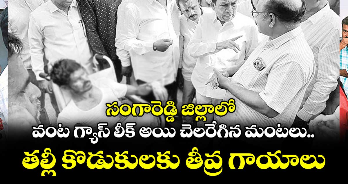 సంగారెడ్డి జిల్లాలో వంట గ్యాస్ లీక్ అయి చెలరేగిన మంటలు..తల్లీ కొడుకులకు తీవ్ర గాయాలు