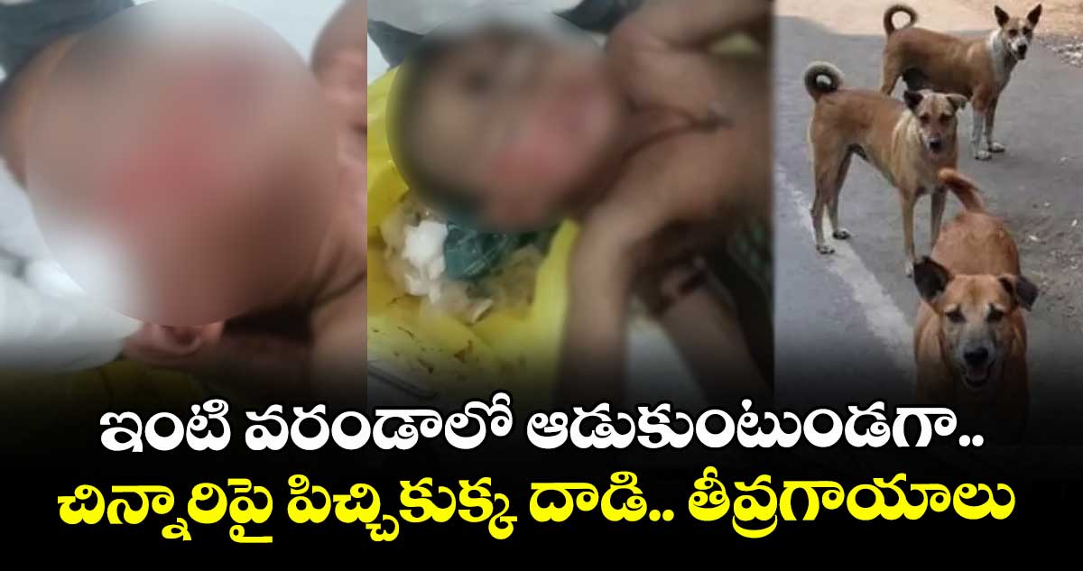 Stray Dogs :ఇంటి వరండాలో ఆడుకుంటుండగా..చిన్నారిపై పిచ్చికుక్క దాడి.. తీవ్రగాయాలు 