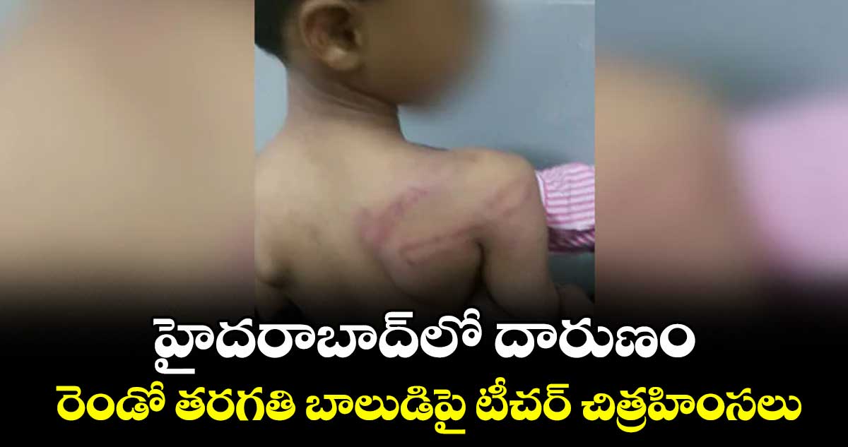 హైదరాబాద్‎లో దారుణం.. రెండో తరగతి బాలుడిపై టీచర్చిత్రహింసలు