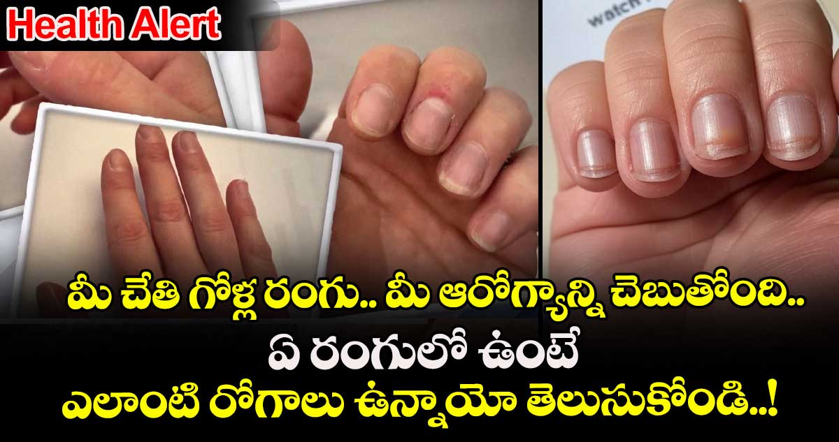 Health Alert : మీ చేతి గోళ్ల రంగు.. మీ ఆరోగ్యాన్ని చెబుతోంది.. ఏ రంగులో ఉంటే ఎలాంటి రోగాలు ఉన్నాయో తెలుసుకోండి..!