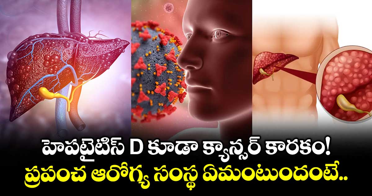 హెపటైటిస్ D కూడా క్యాన్సర్ కారకం!.. ప్రపంచ ఆరోగ్య సంస్థ ఏమంటుందంటే..