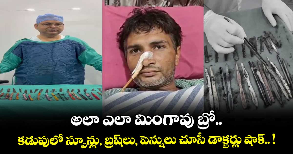 అలా ఎలా మింగావు బ్రో.. కడుపులో స్పూన్లు, బ్రష్⁭లు, పెన్నులు చూసీ డాక్టర్లు షాక్.. !