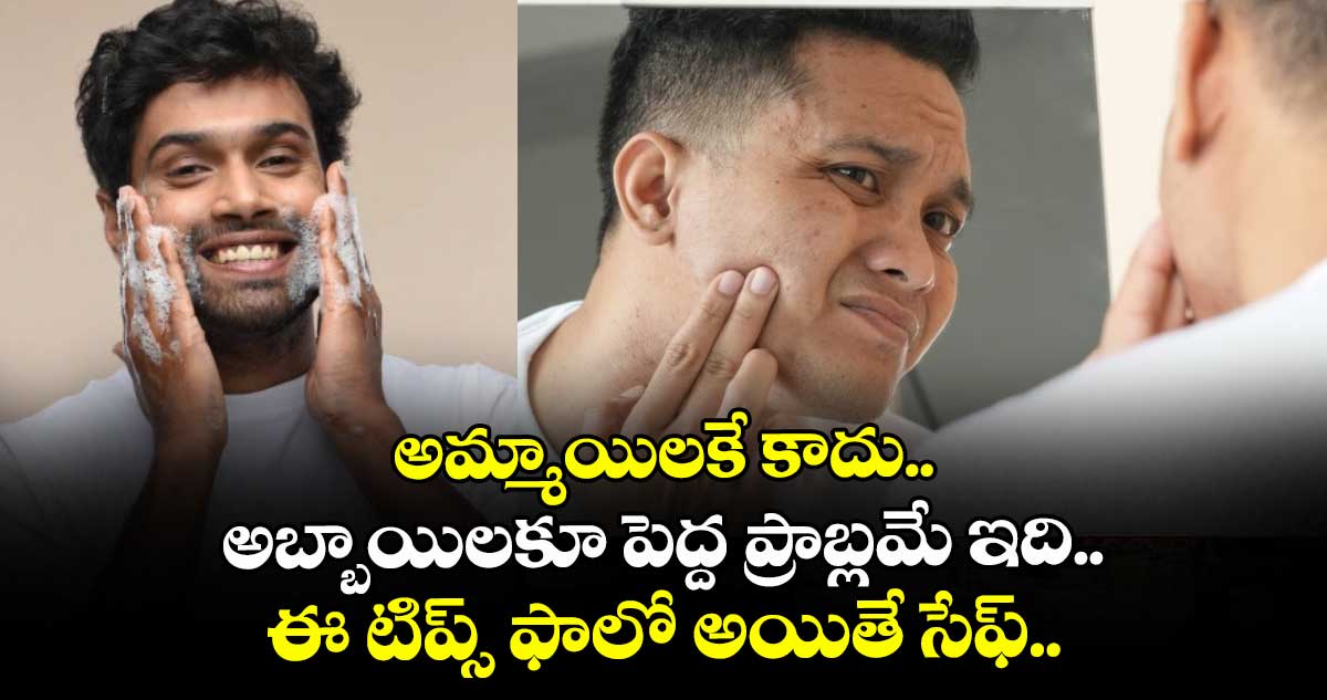 Mens Beauty: అమ్మాయిలకే కాదు.. అబ్బాయిలకూ పెద్ద ప్రాబ్లమే ఇది.. ఈ టిప్స్ ఫాలో అయితే సేఫ్.. 