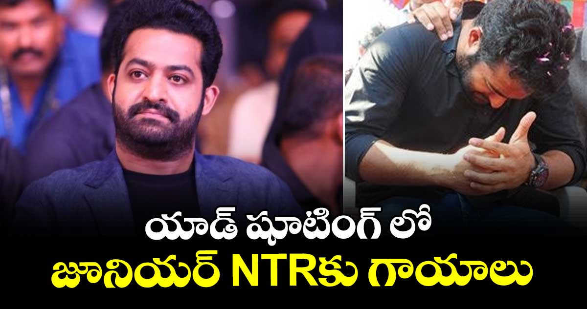 Jr NTR : హీరో జూనియర్ ఎన్టీఆర్ కు గాయాలు... ఫ్యాన్స్ లో ఆందోళన