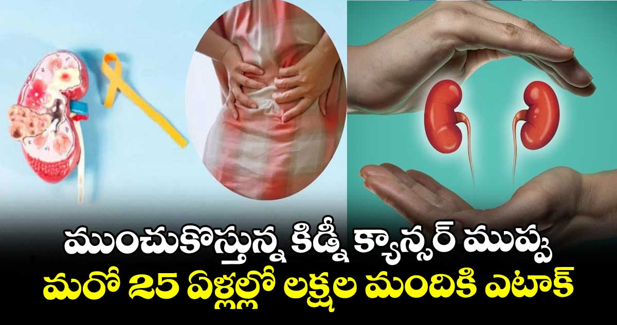 ముంచుకొస్తున్న కిడ్నీ క్యాన్సర్ ముప్పు : మరో 25 ఏళ్లల్లో లక్షల మందికి ఎటాక్