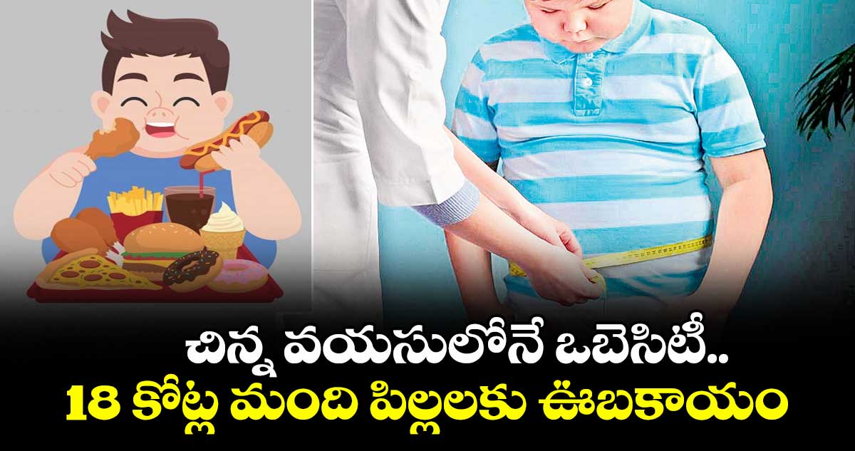 చిన్న వయసులోనే ఒబెసిటీ..18 కోట్ల మంది పిల్లలకు ఊబకాయం