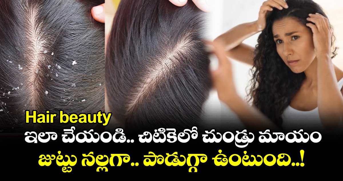Hair beauty: ఇలా చేయండి.. చిటికెలో చుండ్రు మాయం.. జుట్టు నల్లగా.. పొడుగ్గా ఉంటుంది..!