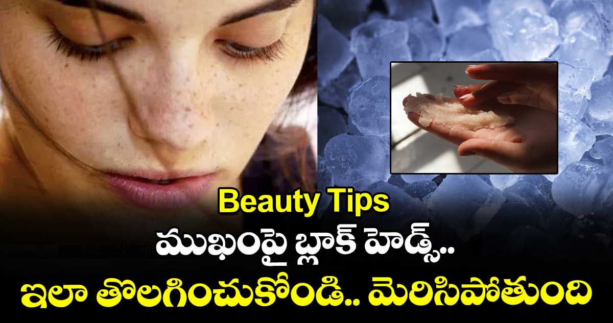 Beauty Tips:  ముఖంపై బ్లాక్ హెడ్స్.. ఇలా తొలగించుకోండి.. మెరిసిపోతుంది