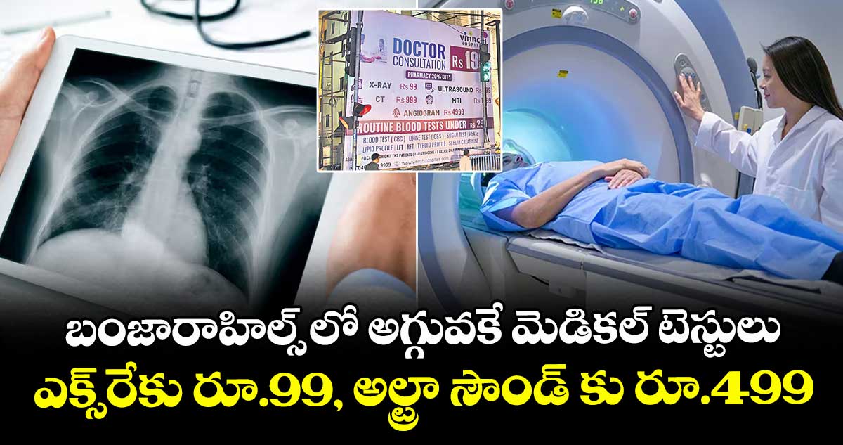 బంజారాహిల్స్ లో అగ్గువకే మెడికల్ టెస్టులు ..ఎక్స్రేకు రూ.99,  అల్ట్రా సౌండ్ కు రూ.499