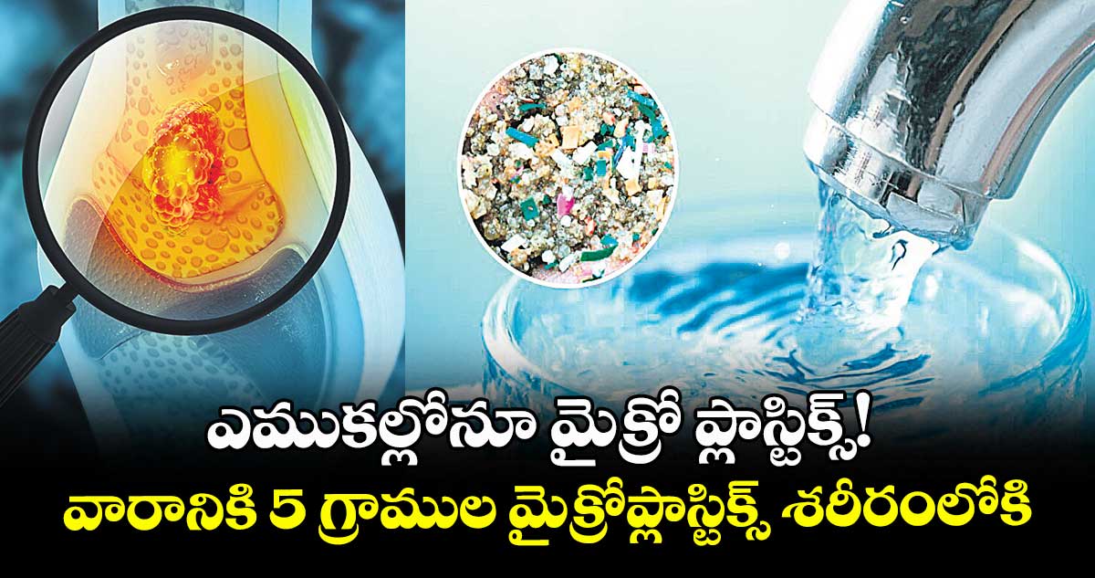 ఎముకల్లోనూ మైక్రో ప్లాస్టిక్స్! .. వారానికి 5 గ్రాముల మైక్రోప్లాస్టిక్స్ శరీరంలోకి..
