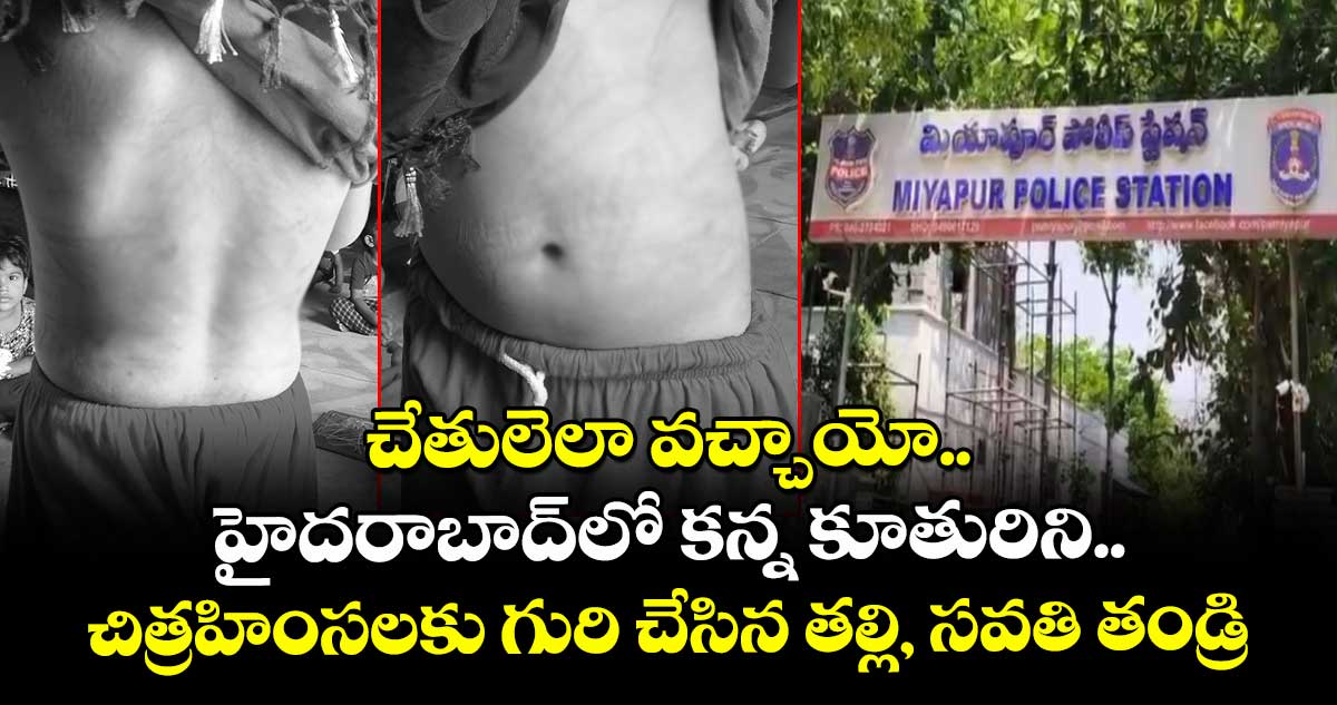 చేతులెలా వచ్చాయో.. హైదరాబాద్⁭లో కన్న కూతురిని చిత్రహింసలకు గురి చేసిన తల్లి, సవతి తండ్రి