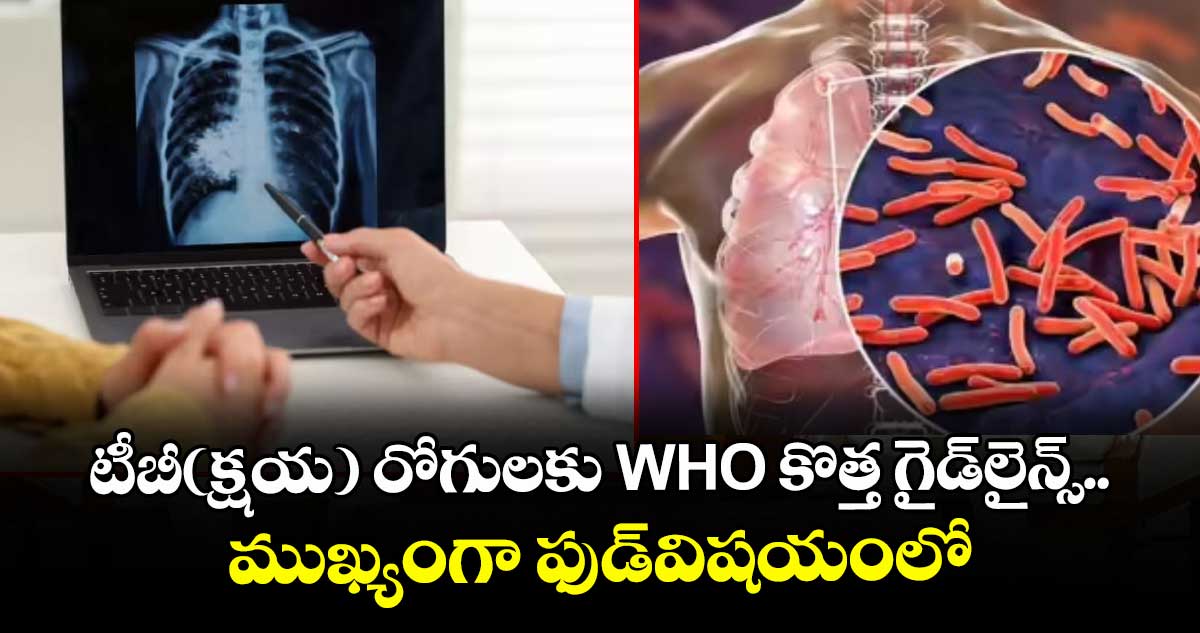 టీబీ(క్షయ) రోగులకు WHO కొత్త గైడ్ లైన్స్..ముఖ్యంగా ఫుడ్ విషయంలో