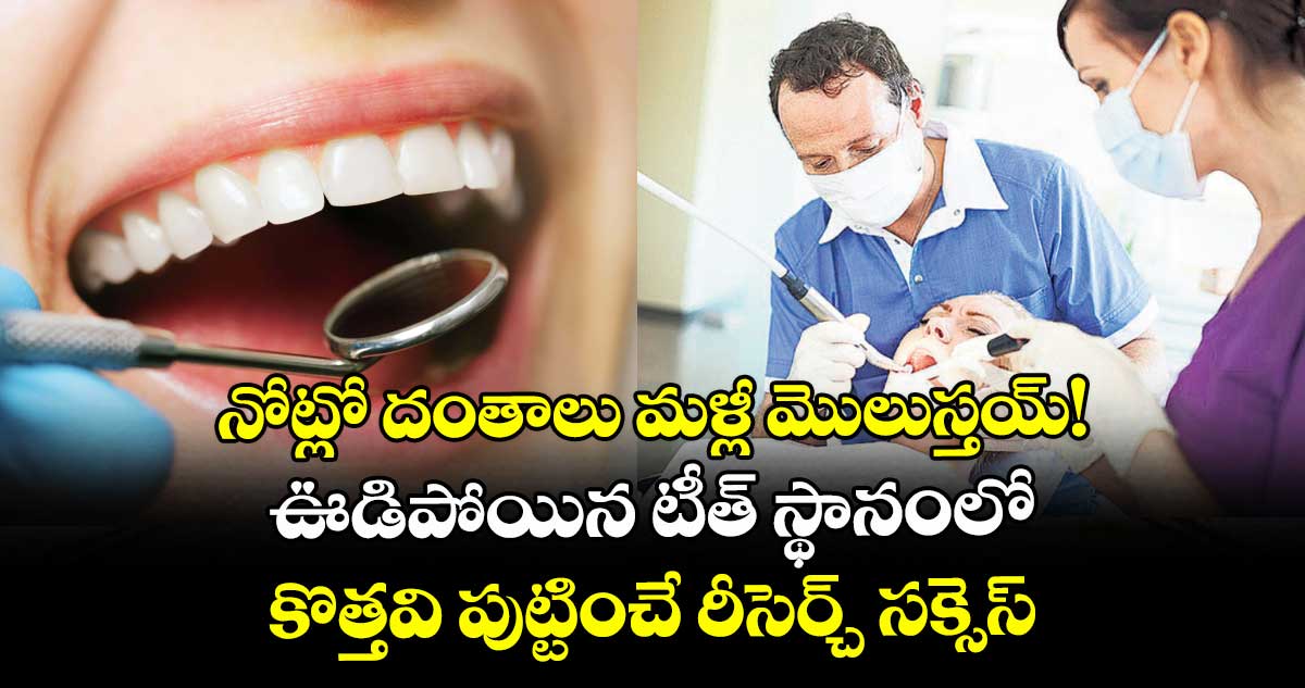 నోట్లో దంతాలు మళ్లీ మొలుస్తయ్!.. ఊడిపోయిన టీత్ స్థానంలో కొత్తవి పుట్టించే రీసెర్చ్ సక్సెస్ 