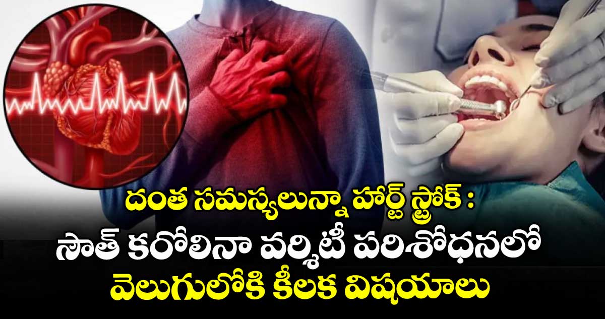 దంత సమస్యలున్నా హార్ట్ స్ట్రోక్: సౌత్ కరోలినా వర్శిటీ పరిశోధనలో వెలుగులోకి కీలక విషయాలు