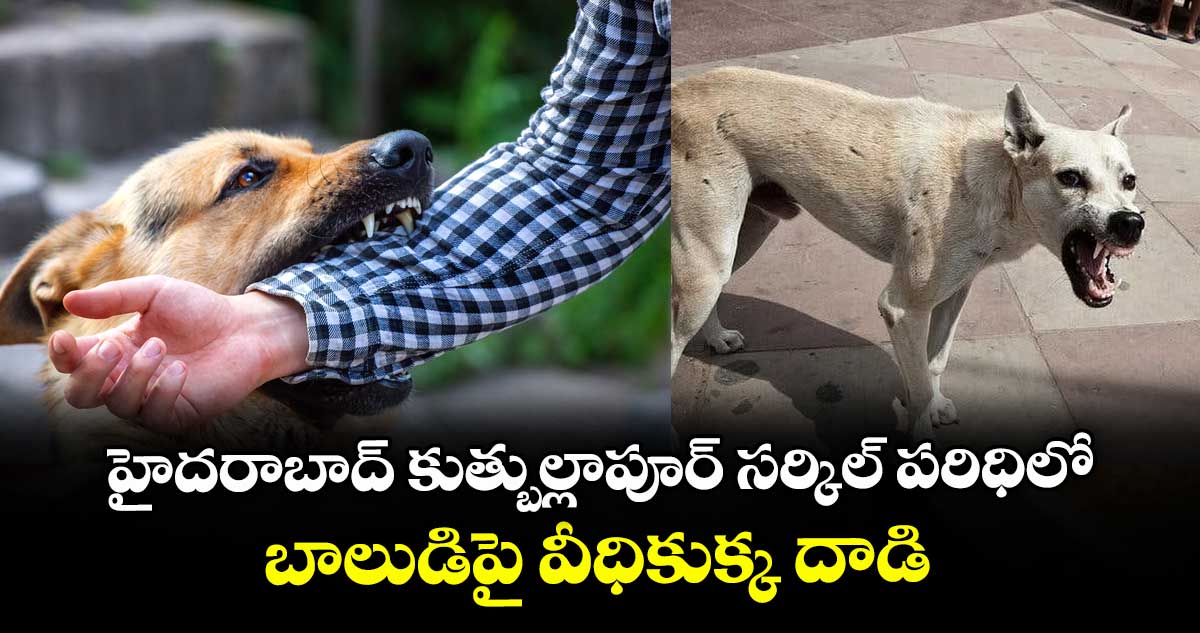 హైదరాబాద్ కుత్బుల్లాపూర్ సర్కిల్ పరిధిలో బాలుడిపై వీధికుక్క దాడి