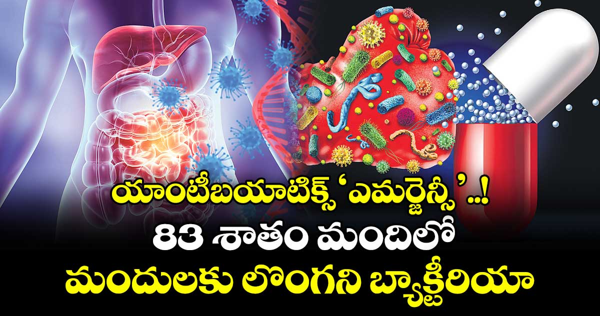 యాంటీబయాటిక్స్‘ఎమర్జెన్సీ’...! 83 శాతం మందిలో మందులకు లొంగని బ్యాక్టీరియా