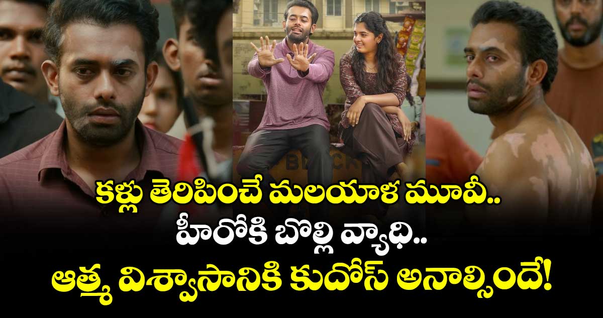 Thalavara OTT : కళ్లు తెరిపించే మలయాళ మూవీ.. హీరోకి బొల్లి వ్యాధి.. ఆత్మ విశ్వాసానికి కుదోస్ అనాల్సిందే!