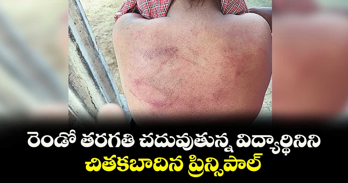 రెండో తరగతి చదువుతున్న విద్యార్థినిని చితకబాదిన ప్రిన్సిపాల్