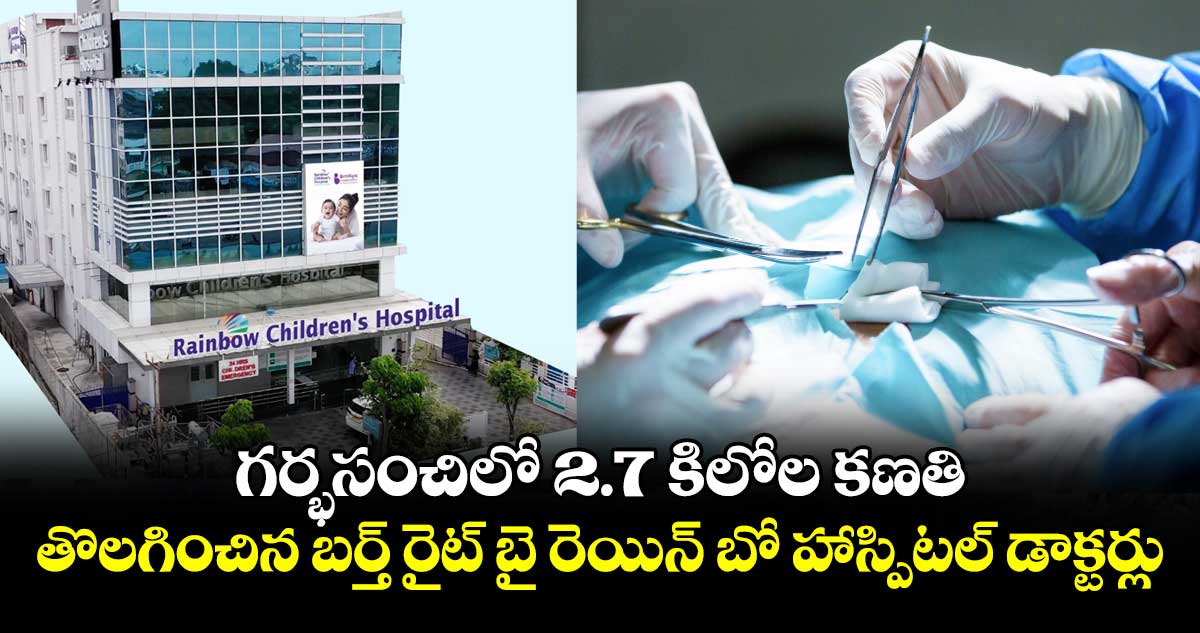 గర్భసంచిలో 2.7 కిలోల కణతి.. తొలగించిన బర్త్‌‌‌‌ రైట్ బై రెయిన్‌‌‌‌ బో హాస్పిటల్ డాక్టర్లు