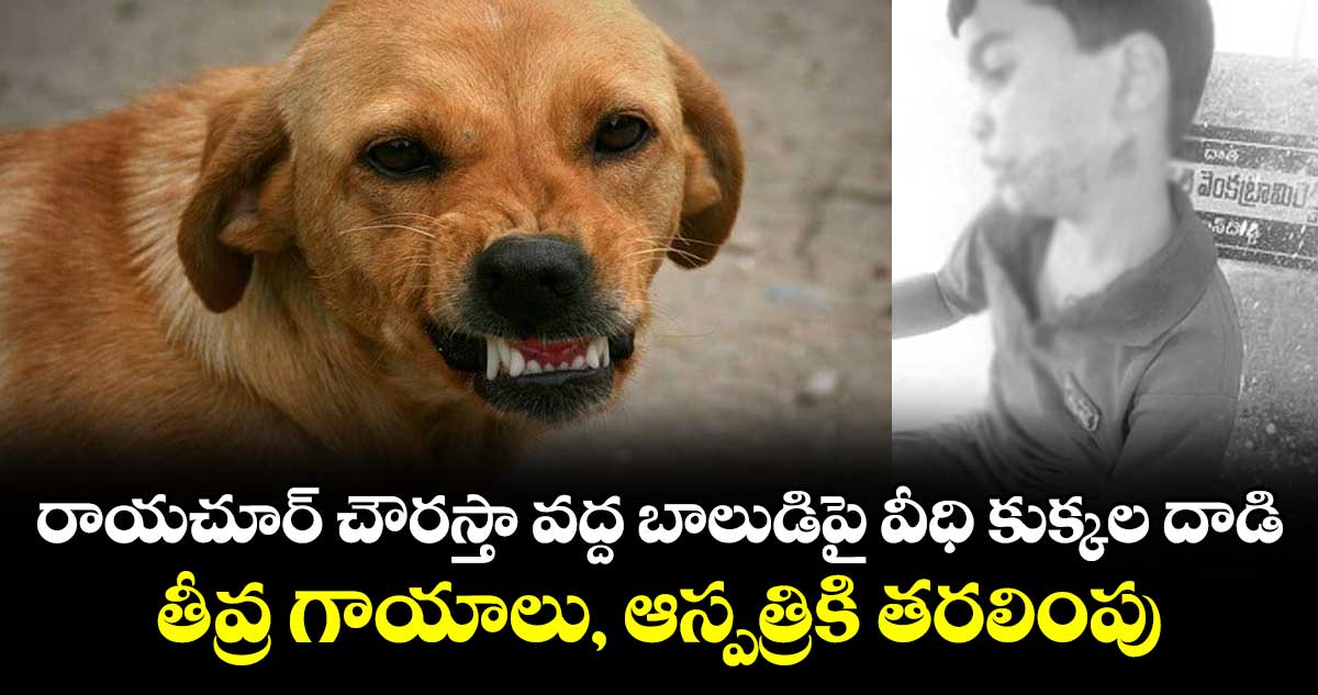 రాయచూర్ చౌరస్తా వద్ద బాలుడిపై వీధి కుక్కల దాడి.. తీవ్ర గాయాలు, ఆస్పత్రికి తరలింపు