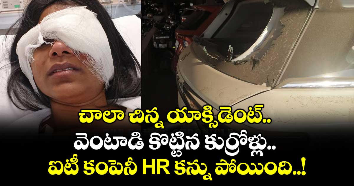 చాలా చిన్న యాక్సిడెంట్.. వెంటాడి కొట్టిన కుర్రోళ్లు.. ఐటీ కంపెనీ HR కన్ను పోయింది..!