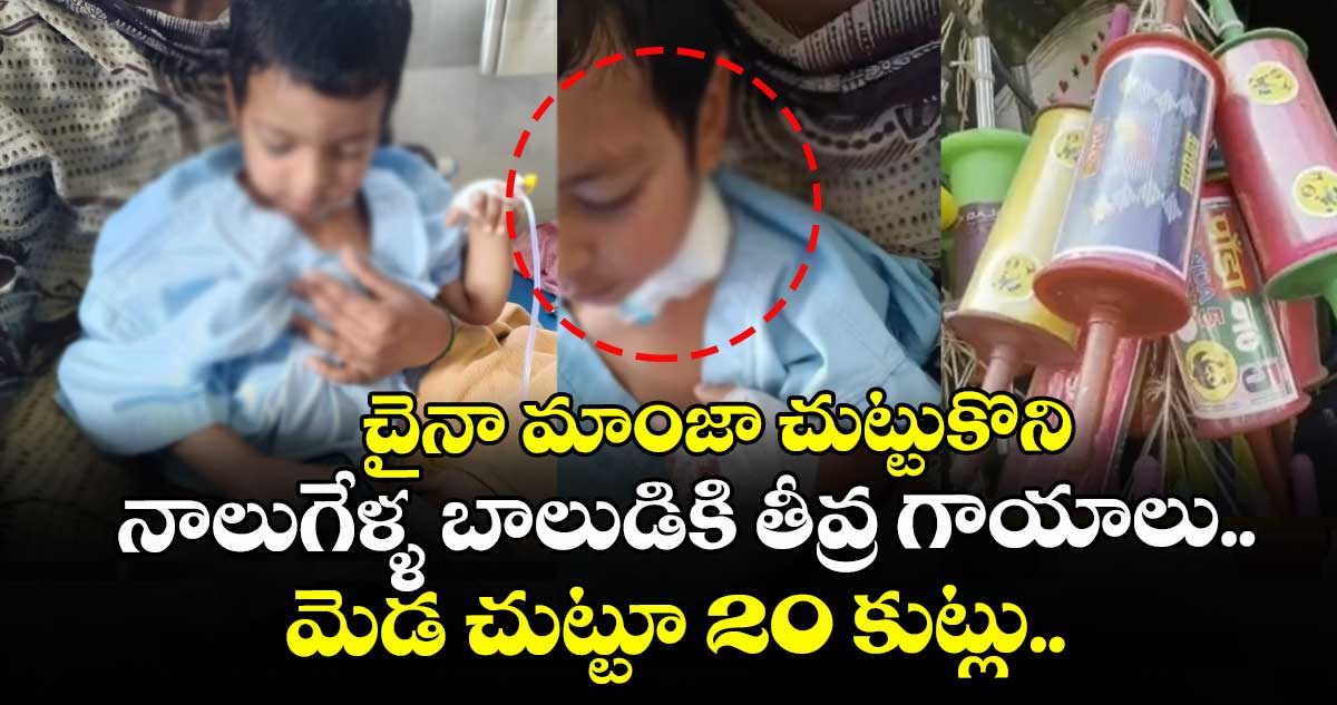 చైనా మాంజా చుట్టుకొని నాలుగేళ్ళ బాలుడికి తీవ్ర గాయాలు.. మెడ చుట్టూ 20 కుట్లు..