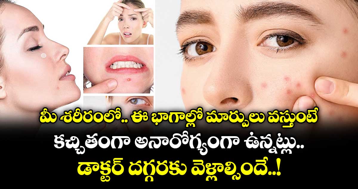 ఆరోగ్య చిట్కాలు - ShareChat