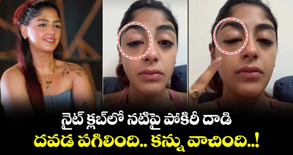 Viral Video: నైట్ క్లబ్⁬లో నటిపై పోకిరీ దాడి : దవడ పగిలింది.. కన్ను వాచింది..!