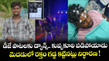 డీజే పాటలకు డ్యాన్స్ చేస్తూ కుప్పకూలాడు.. మెదడులో రక్తం గడ్డ కట్టినట్లు నిర్ధారణ !